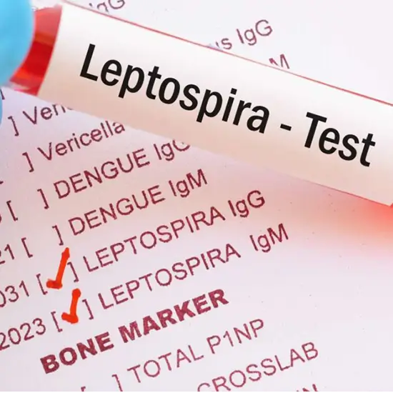 leptospira antibody test